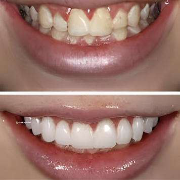 Smile Result 1